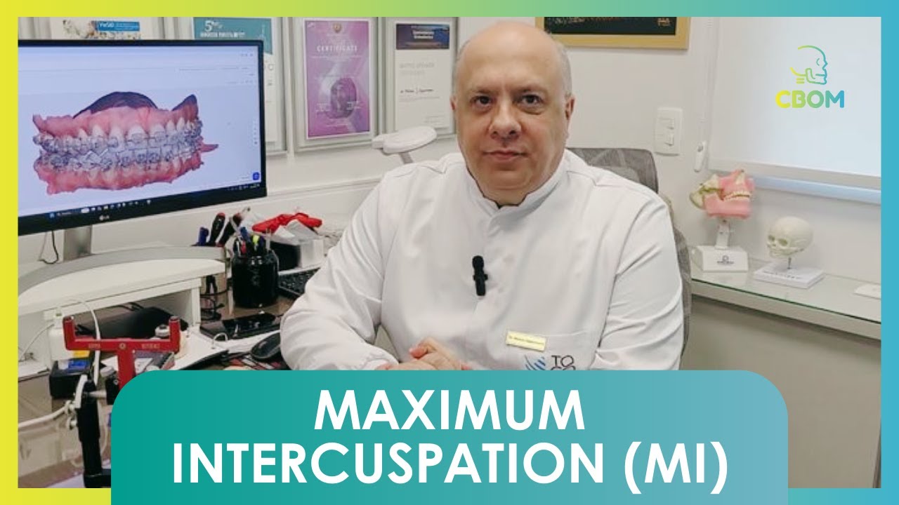 Máxima Intercuspidação (MI)