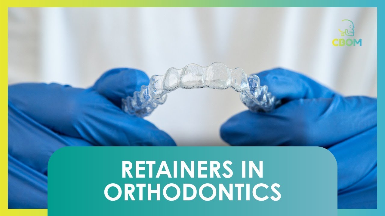 Contenções na Ortodontia