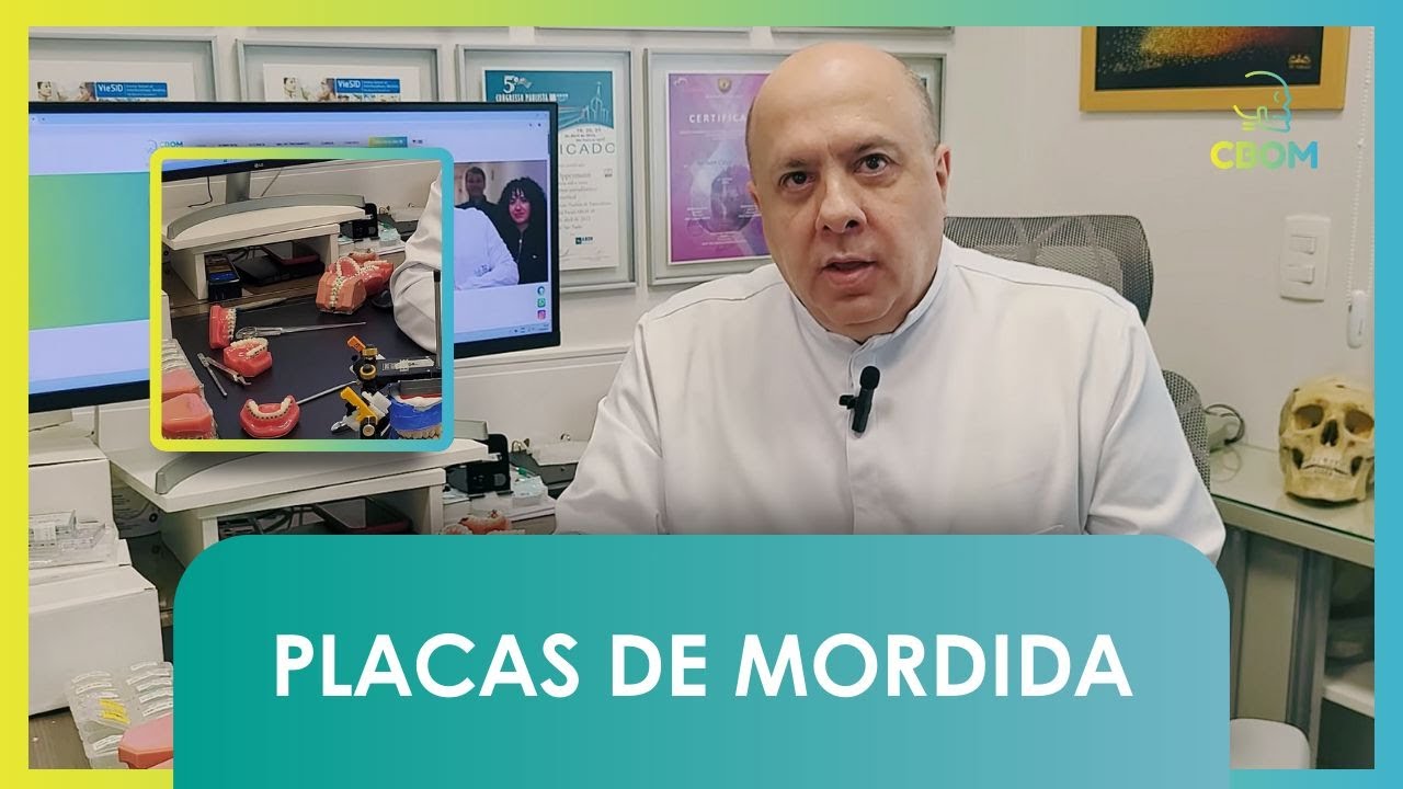 Placas de mordida: indicações e função na ortodontia